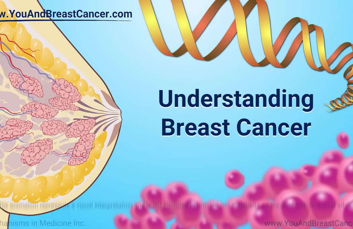 What Women Should Know About Breast Cancer and Early Detection